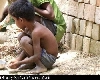 ग़ाज़ा: भीषण लड़ाई की छाया में कुपोषण का शिकार बच्चे, नहीं मिल पा रही राहत