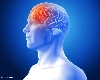 World Brain Tumor Day 2024 - સમય રહેતા ઓળખી લો,  સતત માથાનો દુખાવો અને ચક્કર આવવા મગજની બ્રેઈન ટ્યુમરના લક્ષણો હોઈ શકે