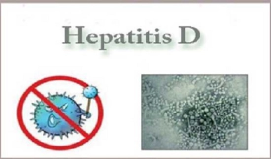Hepatitis D, a liver disease in both acute and chronic forms caused by hepatitis D virus