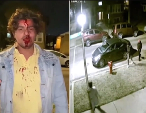 ‘Please help me’: Indian student brutally attacked and robbed by assailants in Chicago (VIDEO)