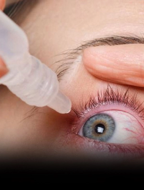 How many types of conjunctivitis are there?
