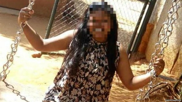 बेंगलुरु में लड़की ने प्रेमी पर 'तेजाब फेंका' - Acid attacks by girl  in Bangalore