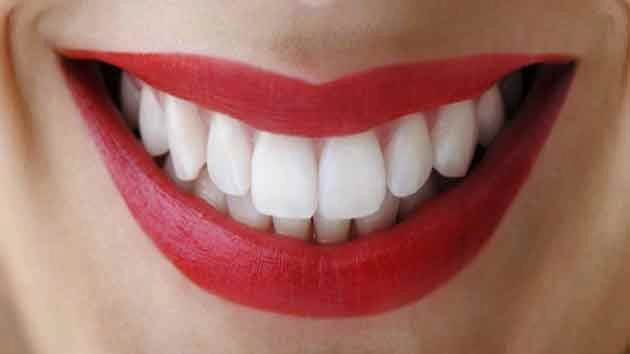Teeth care- પીળા દાંત સફેદ કરવા માટે આ 10 ઘરેલુ ઉપાયોથી