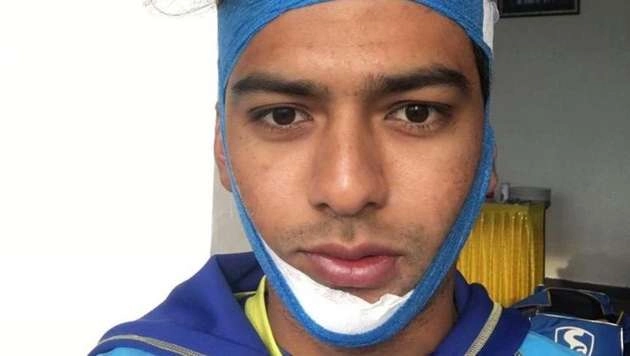 टूटे जबड़े के साथ जड़ा उन्मुक्त चंद ने शतक, दिल्ली को दिलाई जीत - Unmukt Chand Brave effort