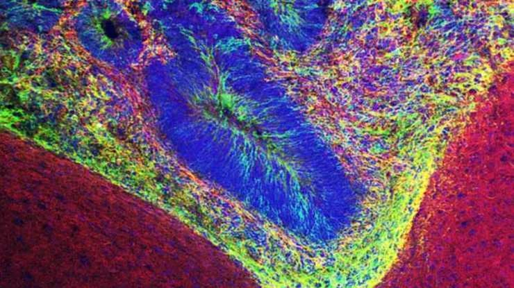 चूहे में विकसित मानवीय मस्तिष्क से होगा इलाज - Grafted brain organoids provide insight into neurological disorders