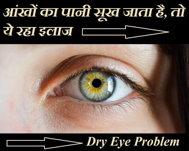 भीषण गर्मी आपकी आंखों का पानी तो नहीं सुखा रही? जानिए ड्राई आई का इलाज - 12 ways to relieve dry eyes