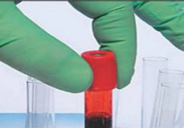IIT खड़गपुर का कमाल, अब मात्र 1 रुपए में कराएं खून की जांच, जानिए नए उपकरण की 5 खास बातें - IIT Kharagpur blood test in only 1 rupee