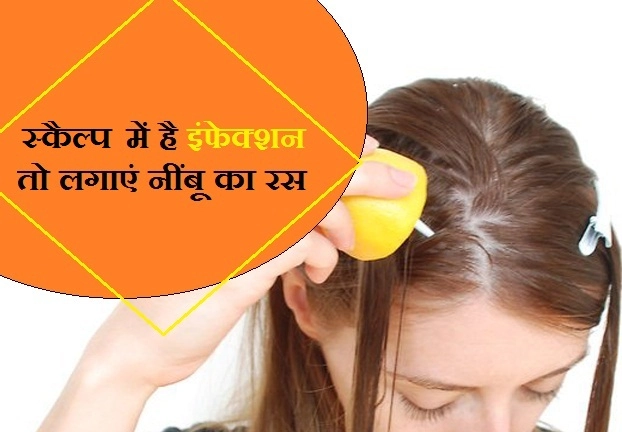 स्कैल्प में है इंफेक्‍शन तो लगाएं नींबू का रस, होंगे 6 फायदे - lemon for scalp problems