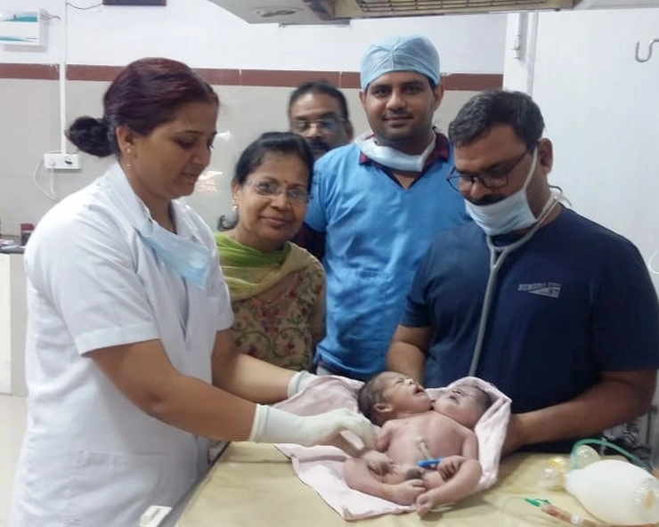 21 साल की महिला ने 2 सिर और 3 हाथ वाले बच्चे को दिया जन्म - The woman gave birth to a wonderful baby