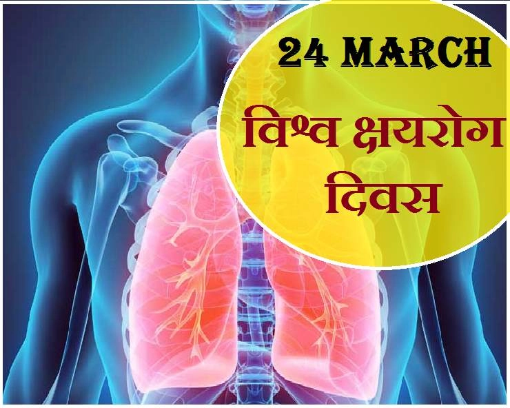 विश्व क्षय रोग दिवस: भारत के लिए 2025 तक टीबी मुक्त भारत का लक्ष्य चुनौती ही नहीं, प्रतिबद्धता भी है - 24 March World TB Day