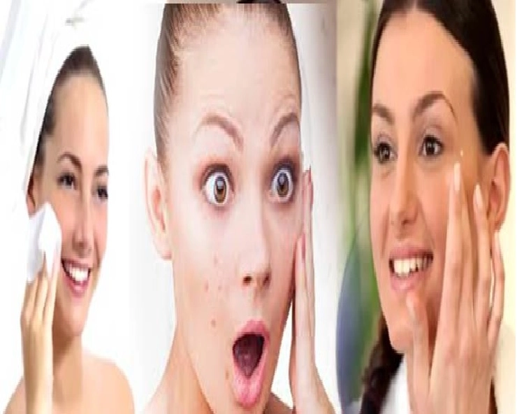 Skin Care : गर्मी में Oily Skin दे सकती है Pimples अपनाएं ये 5 टिप्स