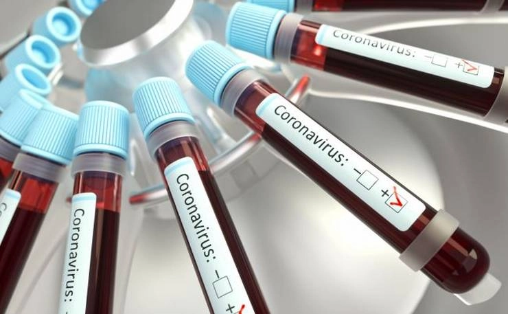 अमेरिका दवा कंपनी Corona virus संक्रमण की दवा का मनुष्यों में परीक्षण शुरू करेगी - Corona virus infection drug will be tested on humans