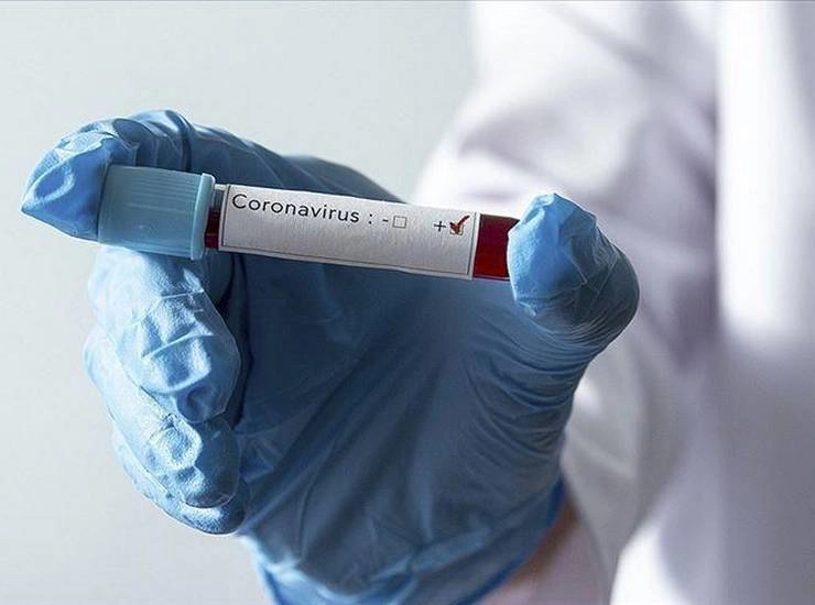 Uttar Pradesh Coronavirus Update : उत्तर प्रदेश में Corona संक्रमण की रफ्तार बरकरार, 46 मौतें - 46 people died in Corona in Uttar Pradesh