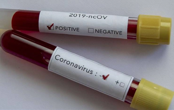 तेलंगाना में एक ही परिवार पर टूटा कोरोनावायरस का कहर, 19 लोग संक्रमित - 19 corona positive in Telangana family