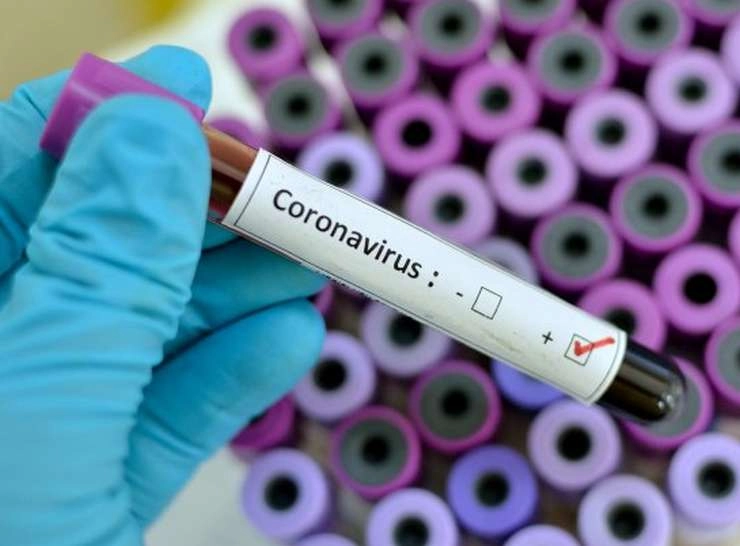 लगातार दूसरे दिन एक्टिव मरीजों की संख्या 20,000 से कम, 11 दिन में 34,731 लोग कोरोना संक्रमित - CoronaVirus India Update : 11 may