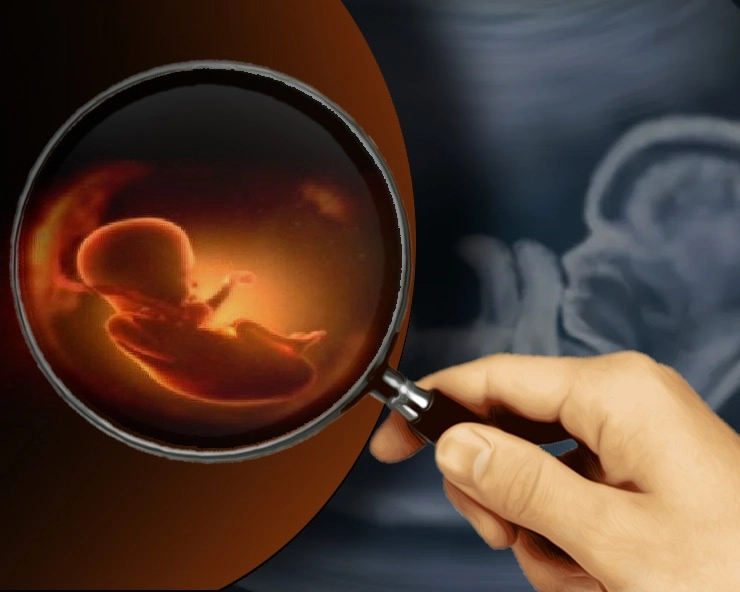 ऑपरेशन खुलवाकर फिर पुत्र ही जन्म देना है, बात जहरीली है... - blog on woman health and Vasectomy