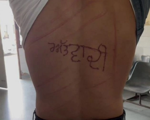 पंजाब की जेल में कैदी की पिटाई, पीठ पर लिखा आतंकी - undertrial prisoner & engraved word ‘Atwadi’ on his back