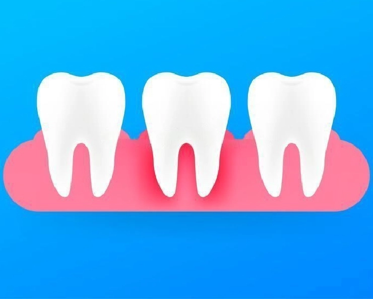 healthy gums: मसूढ़ों को कैसे रखें स्वस्थ, जानिए 5 सरल तरीके