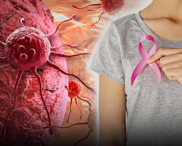 स्तनाचा कर्करोग लक्षणे, कारणे व तपासणी