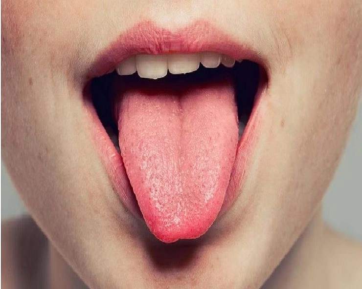आपकी जीभ बताती है आपकी health - Healthy Tongue