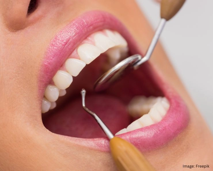 Teeth Cavity Treatment At Home :