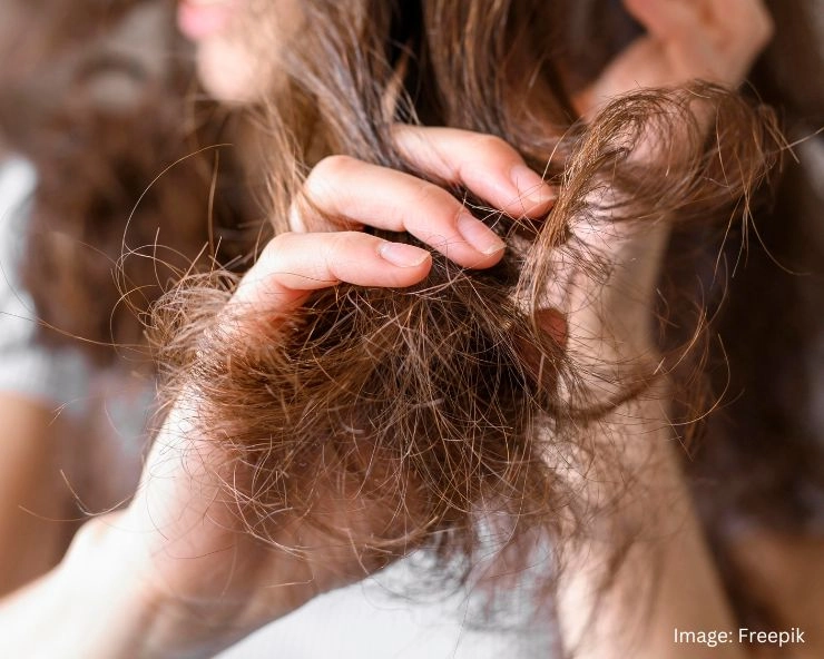 Hair Fall During Monsoon