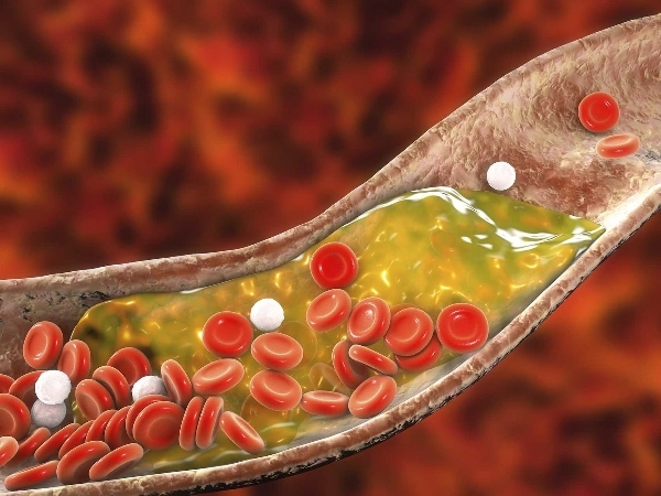 LDL Cholesterol: നാല്‍പതുകളില്‍ മരുന്നില്ലാതെ എങ്ങനെ എല്‍ഡിഎല്‍ കൊളസ്‌ട്രോള്‍ കുറയ്ക്കാം