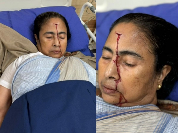 Mamata Banerjee Accident