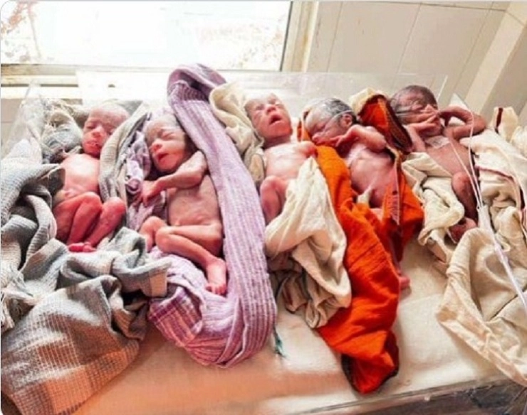 Birth to 5 children at once बिहारमध्ये एका महिलेने एकाचवेळी 5 मुलांना जन्म दिला