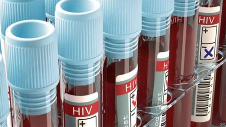 HIV-AIDS Myths एड्सबद्दल 7 सामान्य गैरसमज, जाणून घ्या सत्य