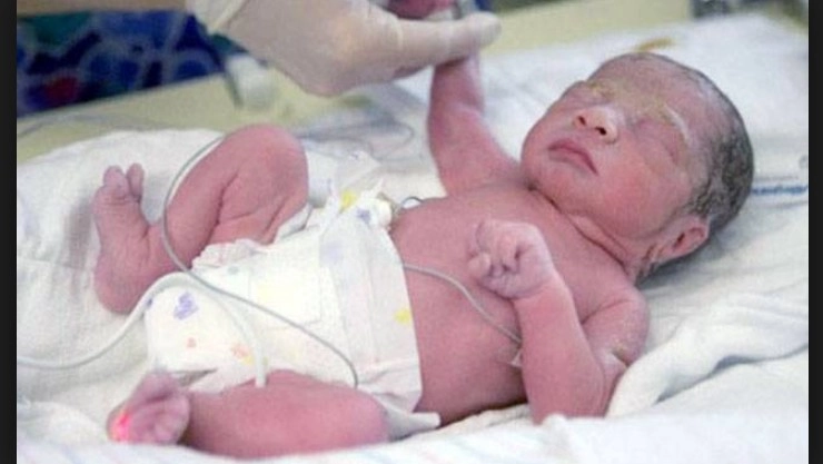 भोपाळच्या श्योपुरमध्ये 22 वर्षीय महिलेने दिला 6 बाळांना जन्म