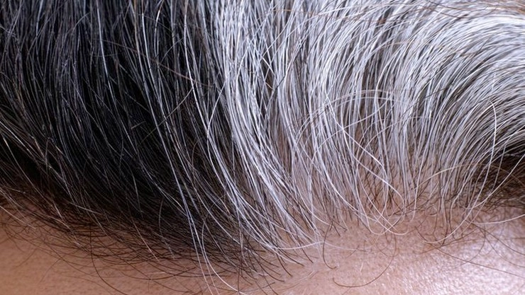 Gray Hair