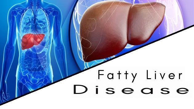Fatty Liver disease