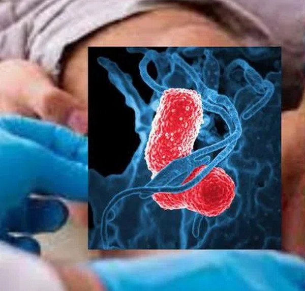 flesh-eating-bacteria