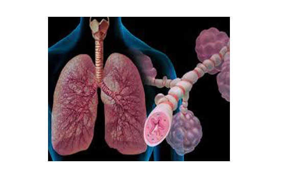 Asthma one of major noncommunicable diseases