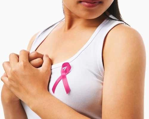 Breast cancer- top cancer in women