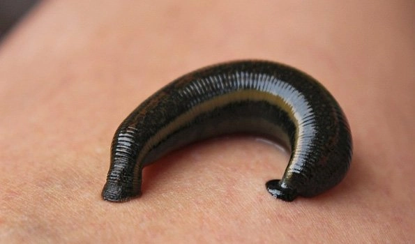 Leeches blood-clotting ability can help develop cures: Study