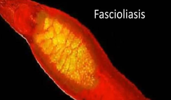 Fascioliasis: An emerging life-threatening disease that mainly affects the liver