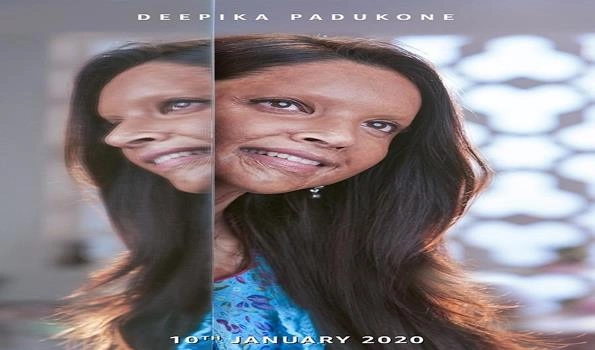 Deepika is first time playing the role of real life character in Chhapak