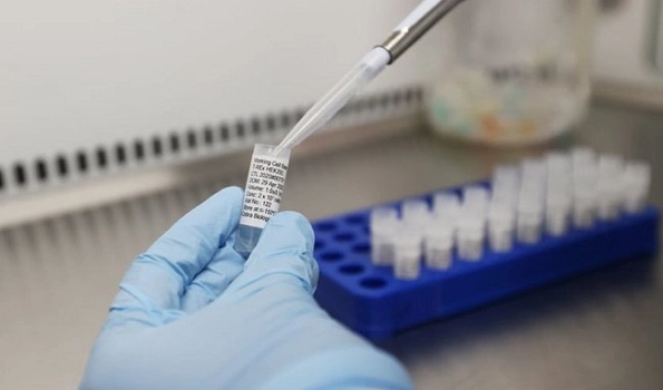 ‘RT-PCR test can miss new Covid-19 variants’