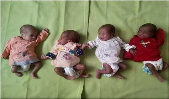 Jammu Docs manage premature birth of quadruplet in private hospital, all COVID infection free