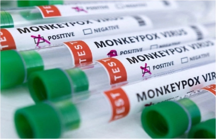 Monkeypox: US declares public health emergency