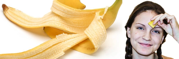 શુ આપ જાણો છો કેળાના છાલટાના ફાયદા ?
