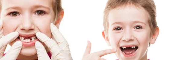 સ્તનપાનનો આ તરીકો ખરાબ કરી શકે છે તમારા બાળકોના દાંત