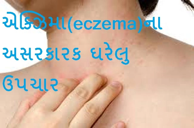 એક્ઝિમા(eczema)ના 3 અસરકારક ઘરેલુ ઉપચાર