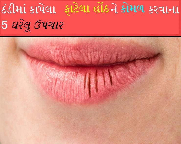 Split lips care- હોઠ ફાટવાની સમસ્યાને દૂર કરવા ઘરેલુ ઉપચાર :