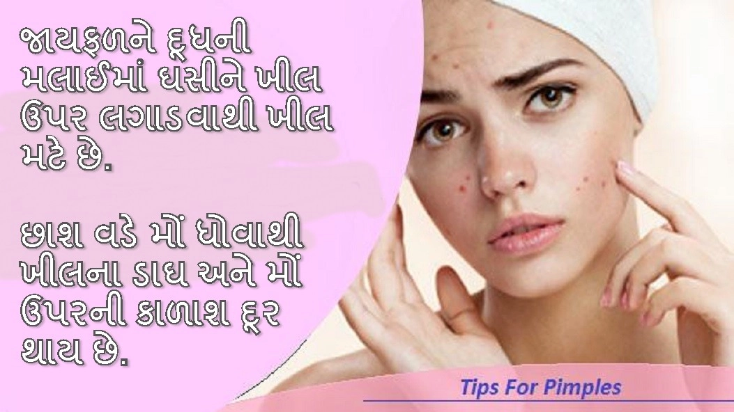Gujarati Beauty Tips- પિંપલ્સ માટે ઘરેલૂ ઉપાય