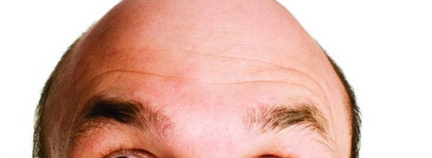 गंजे लोगों के लिए राहतभरी खबर - baldness