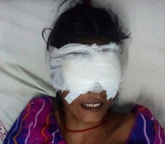 नशे में पत्नी की आंखें फोड़ी - Khandwa crime news
