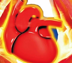 उच्च रक्तचाप है हृदयरोग का सबसे प्रमुख कारण
